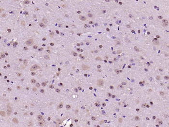 PAK5 Rabbit Polyclonal Antibody