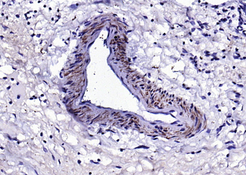 SM22 Alpha Rabbit Polyclonal Antibody