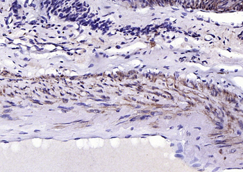 SM22 Alpha Rabbit Polyclonal Antibody