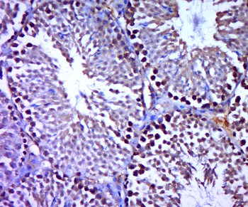 SREBP2 Rabbit Polyclonal Antibody