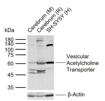 Vesicular Acetylcholine Transporter Rabbit Polyclonal Antibody