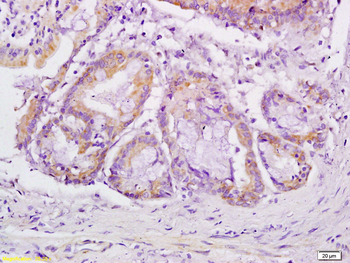 VEGFR3 Rabbit Polyclonal Antibody