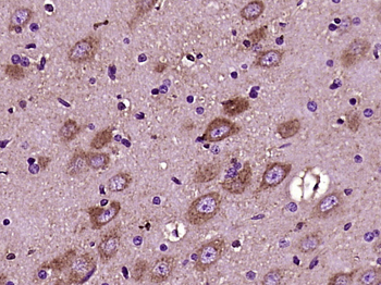 Versican Rabbit Polyclonal Antibody