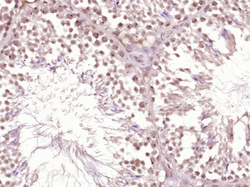 Phospho-DNA PKcs (Thr2609) Rabbit Polyclonal Antibody