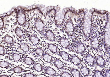 Phospho-SRF (Ser77) Rabbit Polyclonal Antibody