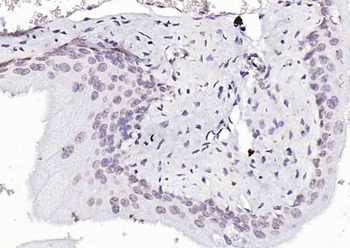 Phospho-SRF (Ser77) Rabbit Polyclonal Antibody