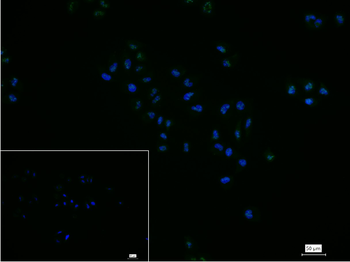 Ki67 Recombinant Rabbit Monoclonal Antibody