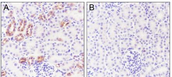 Phospho-IKB Alpha (Ser32 / Ser36) Recombinant Rabbit Monoclonal Antibody