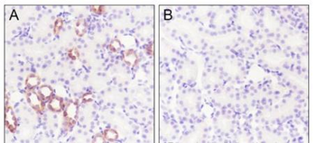 Phospho-IKB Alpha (Ser32 / Ser36) Recombinant Rabbit Monoclonal Antibody