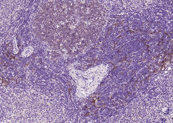 SQSTM1/p62 Recombinant Rabbit Monoclonal Antibody