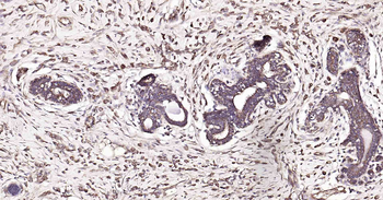PTP1B Recombinant Rabbit Monoclonal Antibody