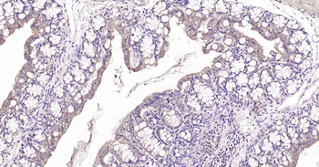 PTP1B Recombinant Rabbit Monoclonal Antibody