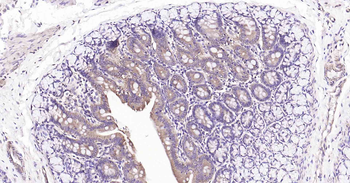 PTP1B Recombinant Rabbit Monoclonal Antibody