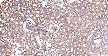PTP1B Recombinant Rabbit Monoclonal Antibody