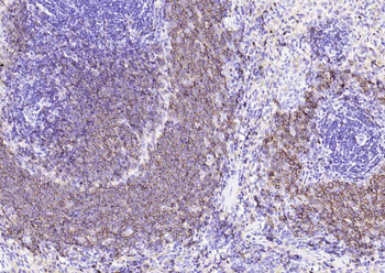 CD20 Recombinant Rabbit Monoclonal Antibody