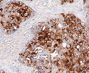 GCDFP15 Recombinant Rabbit Monoclonal Antibody