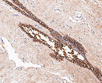 GCDFP15 Recombinant Rabbit Monoclonal Antibody
