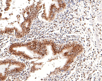 BRD2 Recombinant Rabbit Monoclonal Antibody