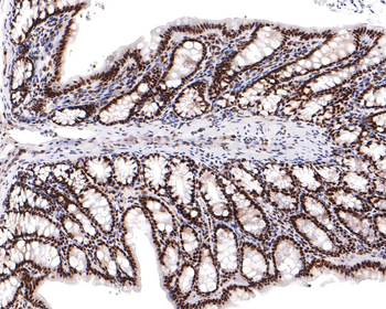 BRD2 Recombinant Rabbit Monoclonal Antibody