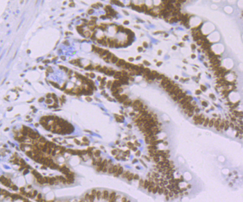 Histone H4 (acetyl K16) Recombinant Rabbit Monoclonal Antibody
