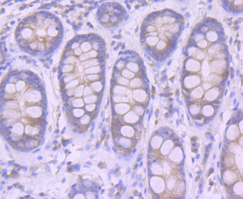 Furin Recombinant Rabbit Monoclonal Antibody