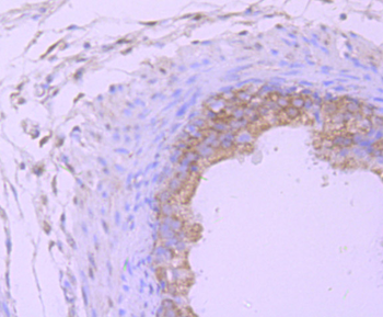 PSMB8 Recombinant Rabbit Monoclonal Antibody