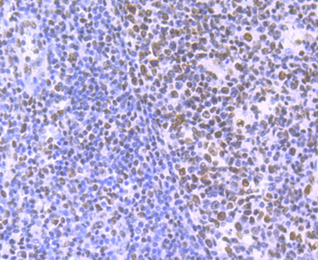 HDAC9 Recombinant Rabbit Monoclonal Antibody