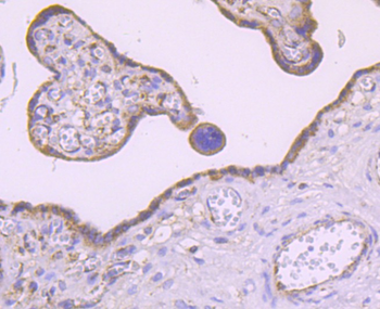 MMP3 Recombinant Rabbit Monoclonal Antibody