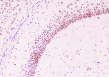 BMAL1 Recombinant Rabbit Monoclonal Antibody
