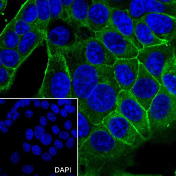 ADRB2 Recombinant Rabbit Monoclonal Antibody