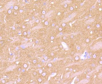 ADRB2 Recombinant Rabbit Monoclonal Antibody