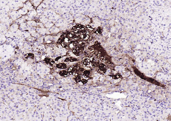 Tyrosine Hydroxylase Recombinant Rabbit Monoclonal Antibody