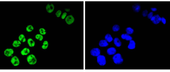 TCF7L2 Recombinant Rabbit Monoclonal Antibody