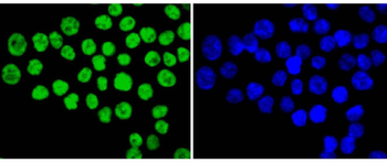 Ku80 Recombinant Rabbit Monoclonal Antibody