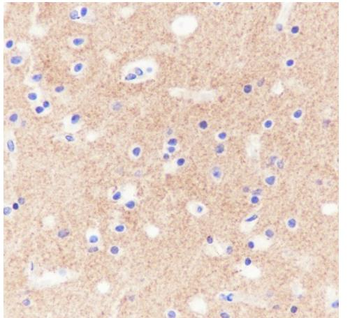 PRNP Recombinant Rabbit Monoclonal Antibody