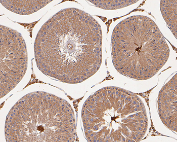 NNOS Recombinant Rabbit Monoclonal Antibody
