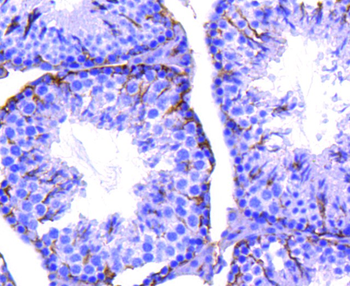 ITGB3 Recombinant Rabbit Monoclonal Antibody