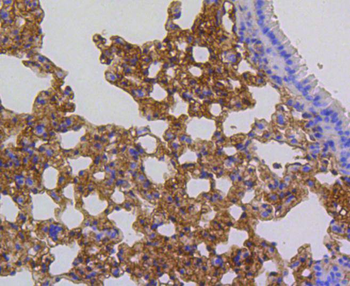 ARPC5 Recombinant Rabbit Monoclonal Antibody
