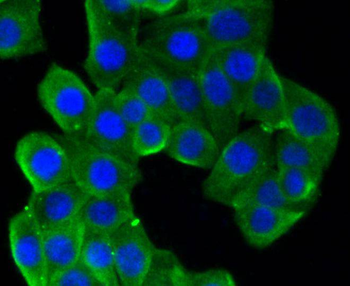Beta Tubulin Recombinant Rabbit Monoclonal Antibody
