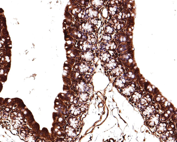 Beta Tubulin Recombinant Rabbit Monoclonal Antibody