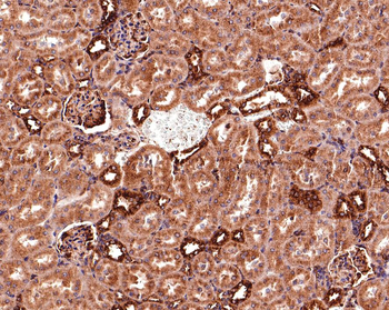 Beta Tubulin Recombinant Rabbit Monoclonal Antibody
