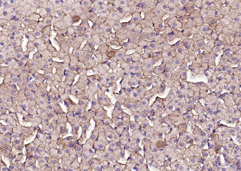 SCARB1/Scavenger Receptor BI Recombinant Rabbit Monoclonal Antibody