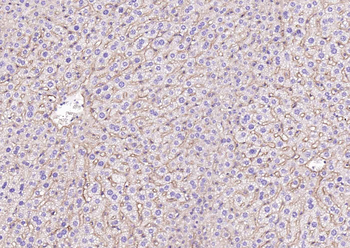 SCARB1/Scavenger Receptor BI Recombinant Rabbit Monoclonal Antibody