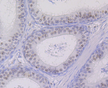 SUN2 Recombinant Rabbit Monoclonal Antibody
