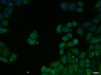 DNA-RNA Hybrid Mouse Monoclonal Antibody