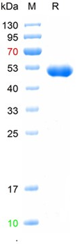 Recombinant human CD4 protein, C-His (HEK293)