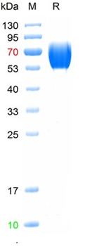 Recombinant human PTH1 receptor protein
