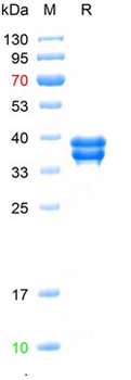 Recombinant human Osteocalcin, C-hFc (HEK293)