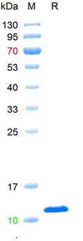 Recombinant human Beta-2-microglobulin, C-His (HEK293)
