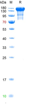 Recombinant SARS-Cov-2 (Omicron, B.1.1.529) Spike trimer protein, C-His (HEK293)